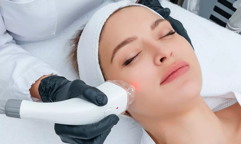 Laser Skin Resurfacing