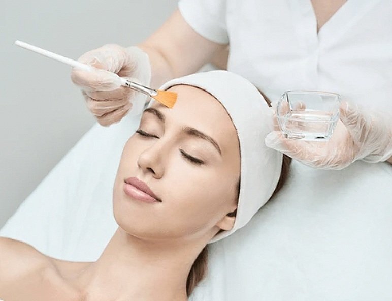 Acne Facial